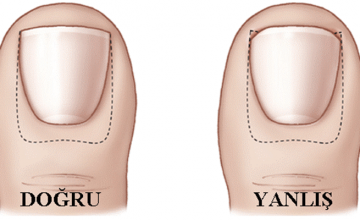 tirnak-kesimi_slider